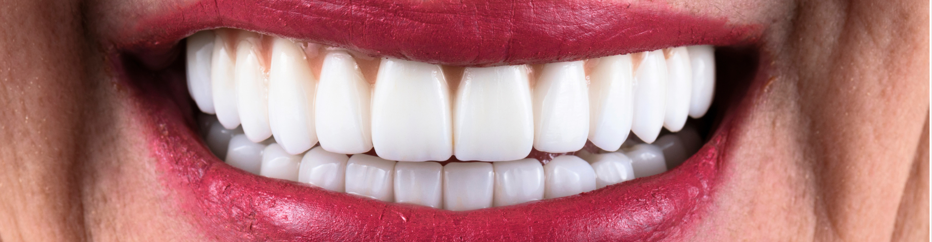 Close-up photo of woman's smile.